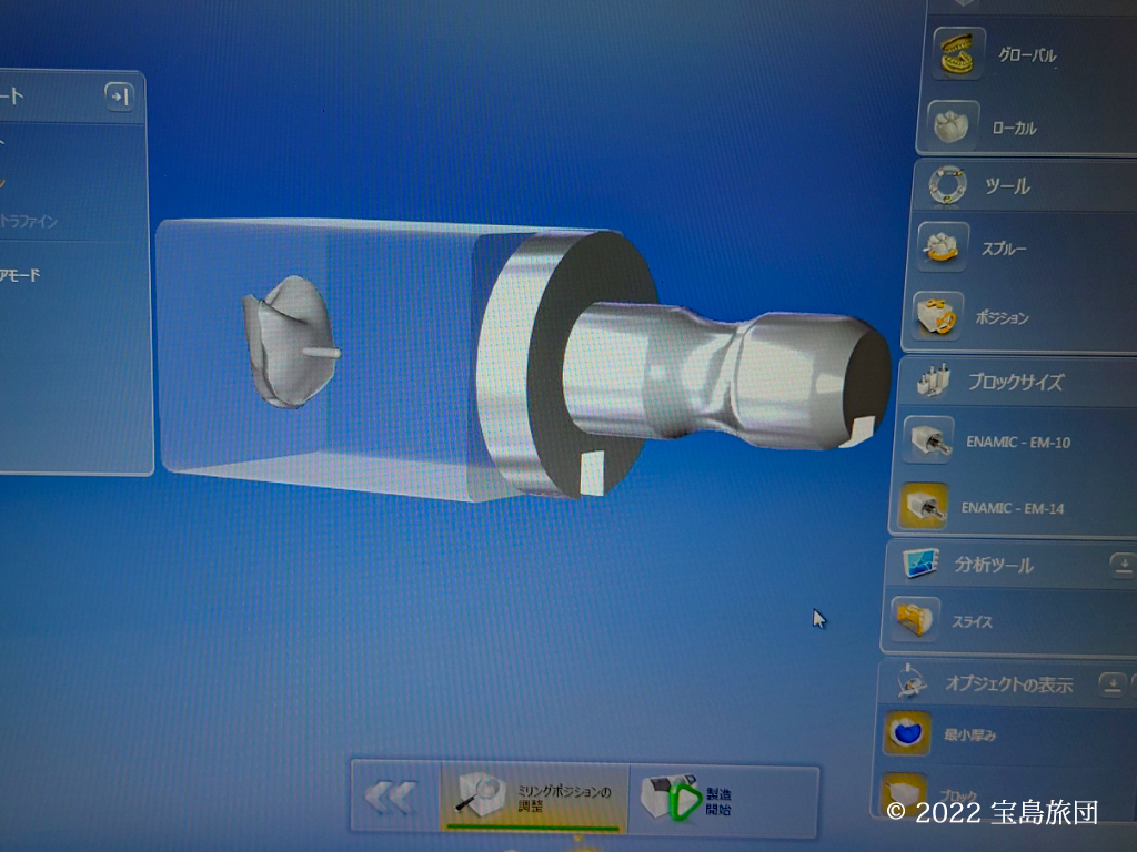 CERECのCAM作業中です。スプルーが希望位置にきた画面です。