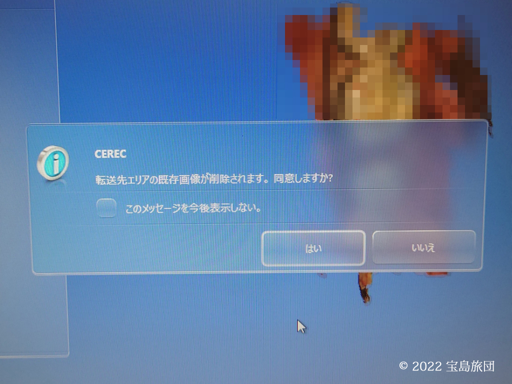 CERECの印象採得の画面です。コピーアンドペーストにより既存画像が削除と表示されています。