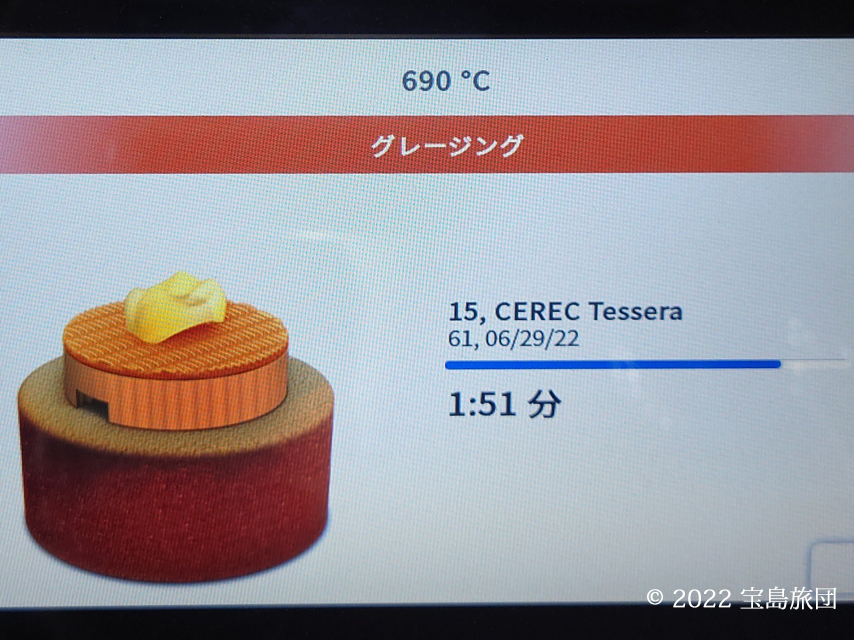 CEREC SpeedFireのTessera焼成中の画面です。