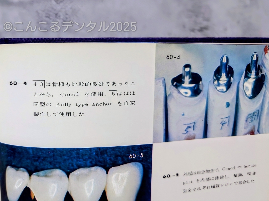 設計アルバムよりケリーアタッチメント