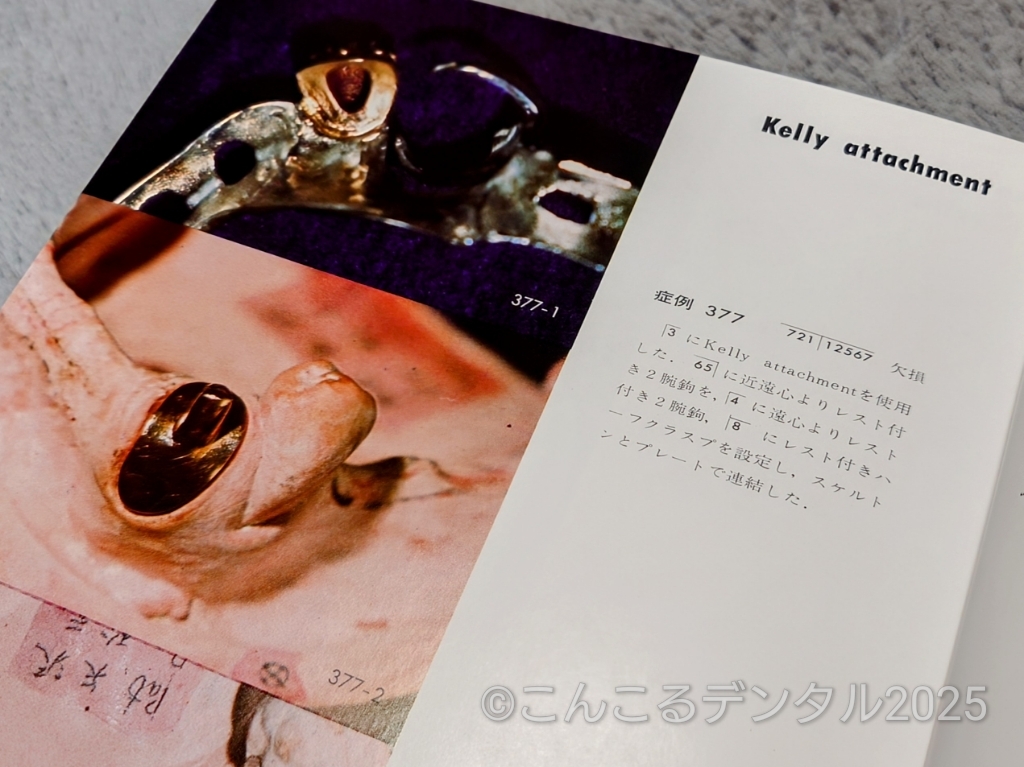 製作法アルバムよりケリーアタッチメント